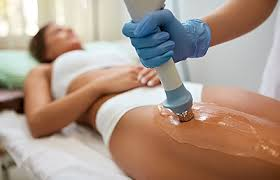 cellulite treatment dubai